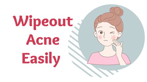 Abolish Acne Easily