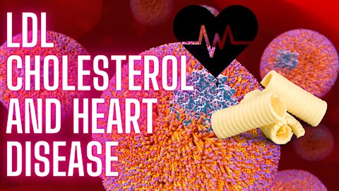 Should You Worry About LDL Cholesterol? [LDL Cholesterol and Heart Disease]