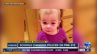 Schools changing policies on pink eye