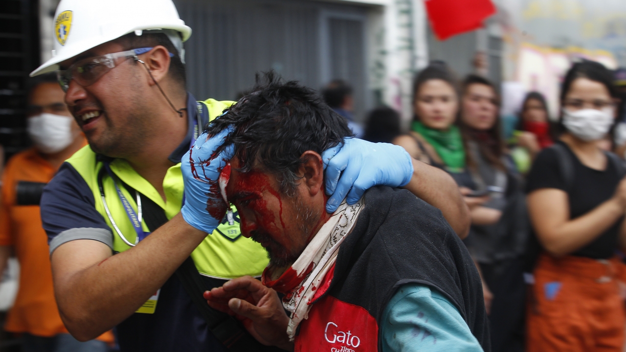 Report: Chilean Security Forces Seeking To Injure, Punish Protesters