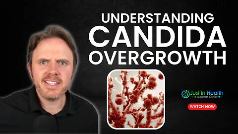 Understanding Candida Overgrowth: Crucial Insights & Diagnostic Tools