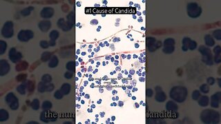 Why Antibiotics Might be Fueling Your Candida Nightmare! 🔍 #Shorts