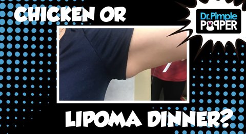 Winner, Winner, Chicken (actually, Lipoma) Dinner