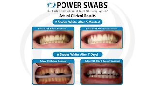 See how you can get a whiter, brighter smile in just minutes with Power Swabs!