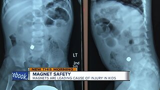 Mother warns other parents of the dangers of magnets