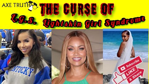 L.G.S The Curse of having Lightskin Girl Syndrome