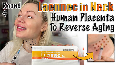 Traditional Meso therapy with Laennec, Human Placenta, AceCosm | Code Jessica10 Saves you Money