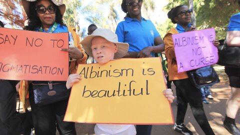 Authors, Actor Hope To Reduce Stigma Surrounding People With Albinism
