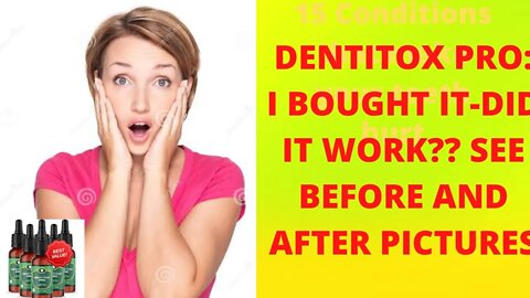 Dentitox Pro Review - I Bought It - DID IT WORK?? SEE Before & After Pictures!