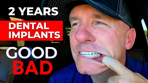 The GOOD and BAD Of My Dental Implants After 2 Years