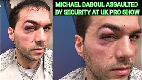 MICHAEL DABOUL ASSAULTED IN UK AT 2 BROS PROMOTION