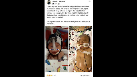 Baby Alexander died after receiving va€€!nated blood during a transfusion 😿