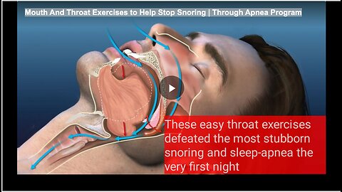 Mouth And Throat Exercises to Help Stop Snoring | Through Apnea Program