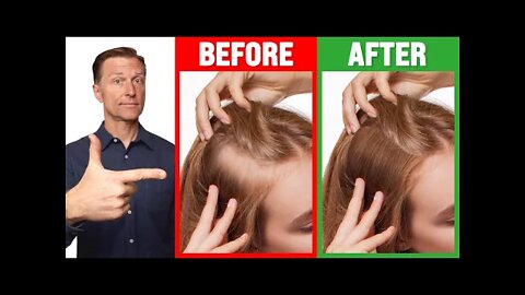 Grow THIN Hair into THICK Hair - Dr. Berg