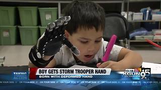 Valley boy gets 'Stormtrooper' prosthetic hand from non-profit More Foundation