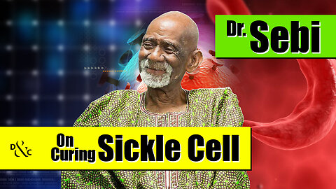Dr. Sebi on Curing Sickle Cell Anemia