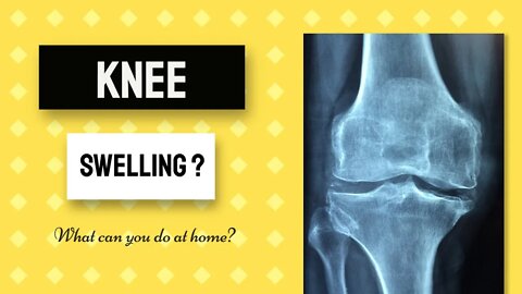 Knee swelling? What can you do at home? Part 1
