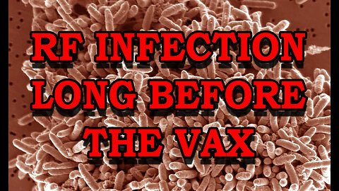 RADIO FREQUENCY INFECTION LONG BEFORE THE VAX - SHEWANELLA NANO WIRES