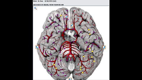 Stroke Recovery Protocols Update Sun Apr 24th 2022