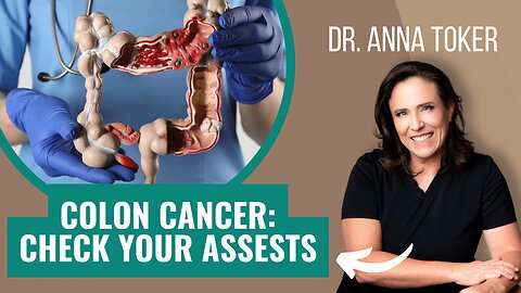 Colon Cancer: Check Your Assets!