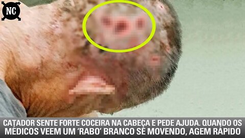 Catador sente forte coceira na cabeça e pede ajuda. Quando os médicos veem um ‘rabo’ branco mexendo