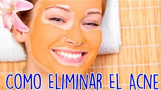 Como Eliminar El Acne