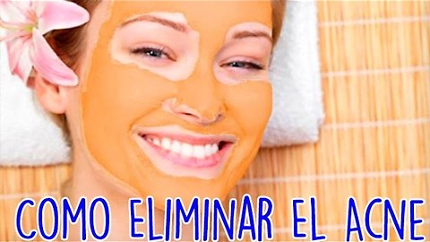 Como Eliminar El Acne