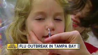 Doctors reporting higher levels of flu in Tampa Bay area