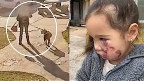 Best funny videos prank Hero Cat Saves Toddler From Dog Attack _ INSANE footage