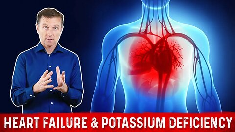 Causes & Symptoms of Potassium Deficiency – Dr. Berg