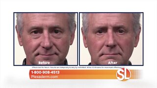 Look instantly younger with Plexaderm