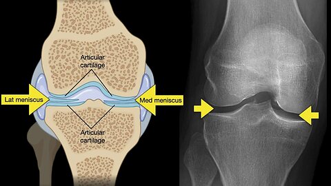 Anatomy of Knee X-rays