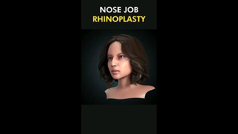 Rhinoplasty 3D_Nose job