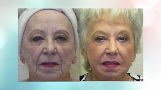 Get ready to look decades younger with Renuvion from Advanced Image Med Spa