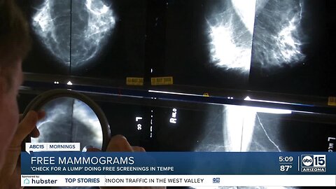 Free mammograms at a mobile clinic in Tempe on Thursday
