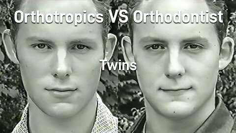 Why You Shouldn't Extract Teeth: Orthotropics VS Orthodontist | Dispatches 1999