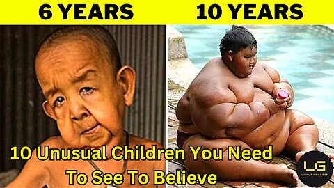 10 Unusual Children You Need To See To Believe