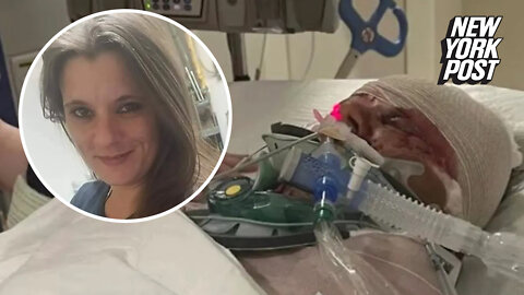 Disarming wake up: Mom attacked by pit bulls shocked by arm amputation after waking from coma