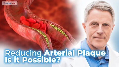 Reducing Arterial Plaque - Is it Possible?