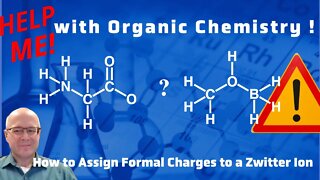 How Do I Assign Formal Charge in Zwitter Ions Help Me With Organic Chemistry!