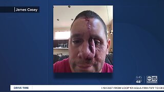 Trooper James Casey, shot in the face during traffic stop, speaks out after sentencing of Ramon Bueno