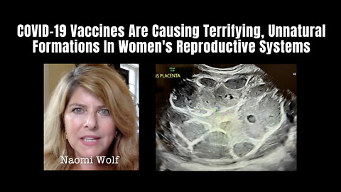 COVID-19 Vaccines Are Causing Terrifying, Unnatural Formations In Women's Reproductive Systems