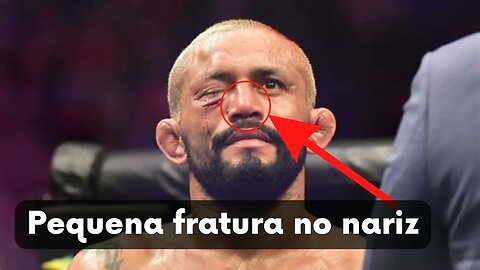 Deiveson Figueiredo quebra nariz em luta contra Brandon Moreno no UFC RIO
