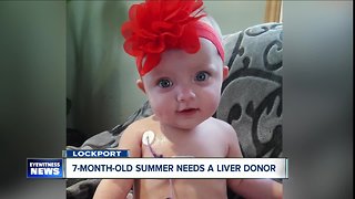 Seven-month-old Summer needs a liver donor