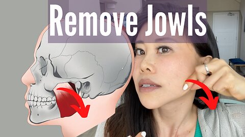 Remove Jowls