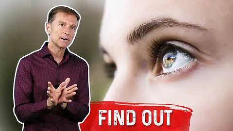 7 Things Your Eyes Can Tell You About Your Blood Sugars – Dr.Berg