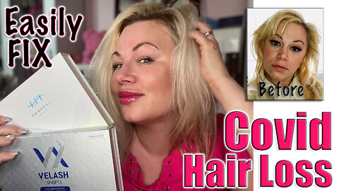 How to Fix Covid Hair Loss (I Did) | Code Jessica10 saves you Money at All Approved Vendors