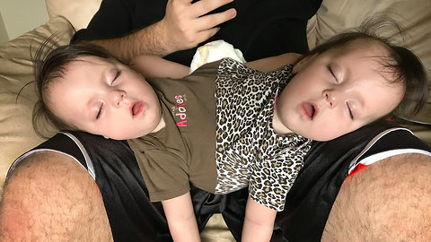 Conjoined Twins Are Perfectly Healthy And Have Bubbly Personalities