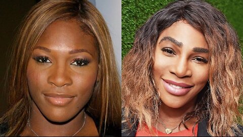 Serena Williams GOES VIRAL For FACE CHANGE & Men Get BLAMED For Her LOOKING WEIRD?