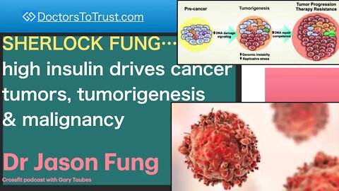 JASON FUNG 5 | SHERLOCK FUNG…high insulin drives cancer tumors, tumorigenesis & malignancy